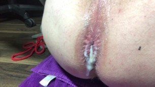 Before and after gape doc Johnson